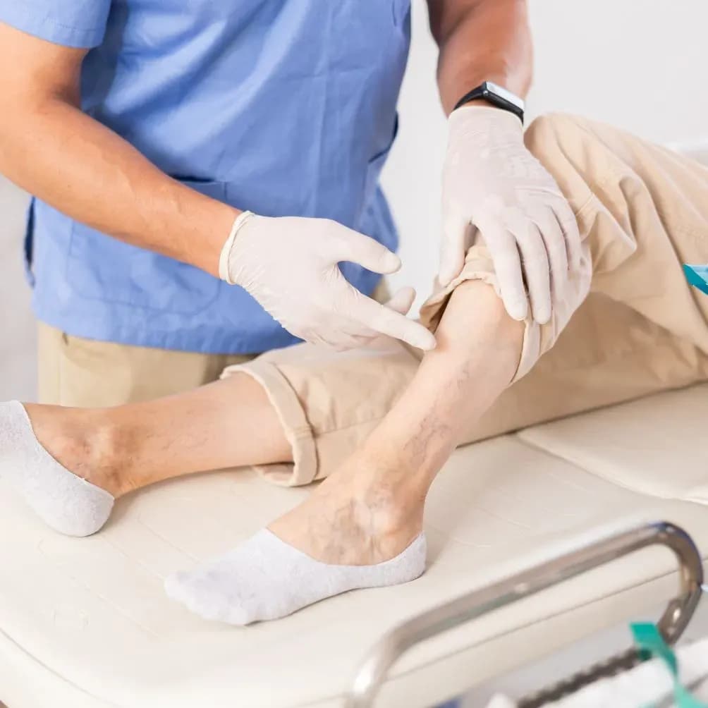 Endovenöse Lasertherapie gegen Krampfadern in Salzburg – Effektiv & schmerzfrei