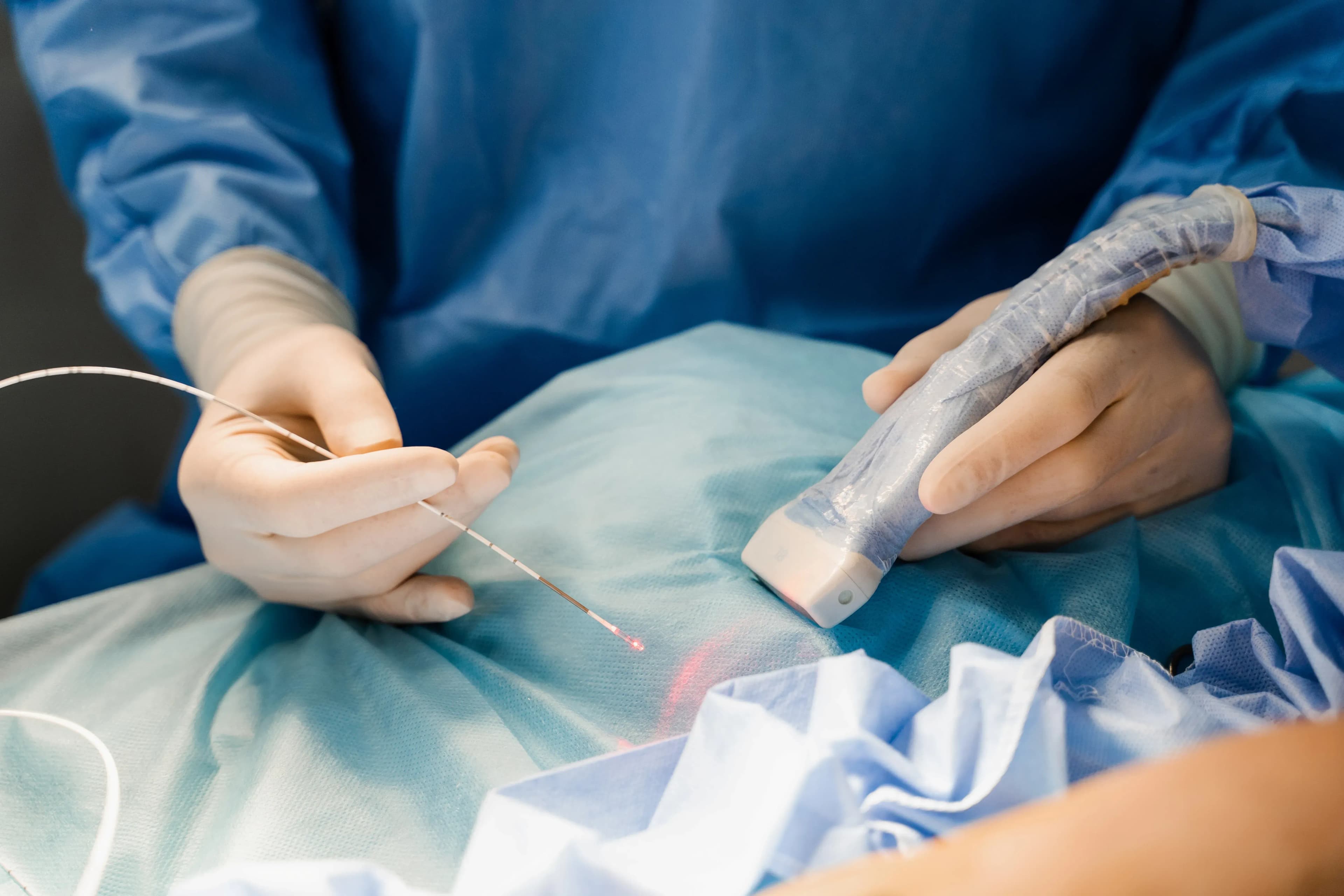 Venenlaser oder OP bei Krampadern? Die besten Optionen für Ihre Beine
