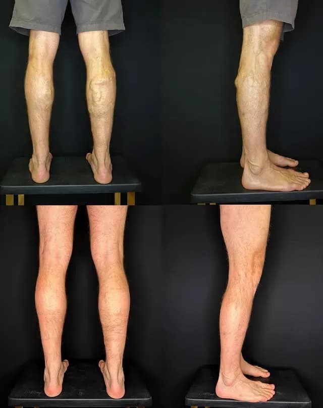 Minimalinvasive Venentherapie bei Salzburg – Welche Methode passt zu Ihnen?